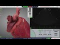 Viewing the 3D Heart - HeartWorks Issue 10