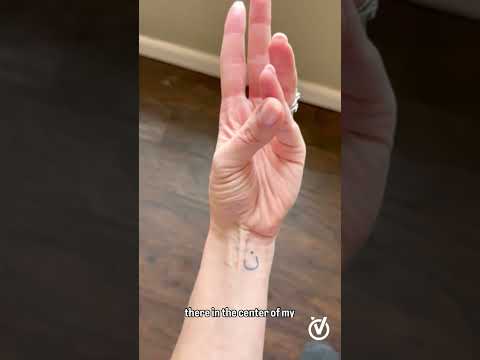 What happens if you cut your Palmaris longus?