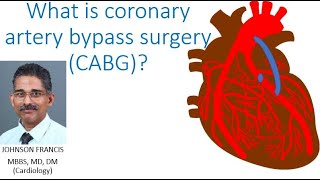 What is coronary artery bypass surgery CABG?
