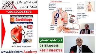 Pericardial Effusion  #cme #internal_medicine #medical #usmle #محاضرات_باطنة