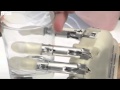 BBC News - Bionic hand allows patient to 'feel'