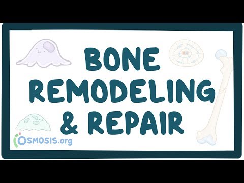 What are the 4 steps of bone remodeling?