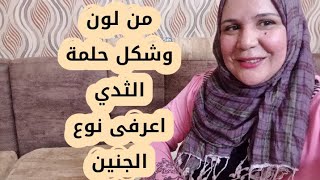 لون وشكل حلمة الثدى وعلاقتها بنوع الجنين