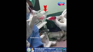 அகிலிஸ் தசை நார் பாதிக்கப்பட்ட 42 வயது பெண்