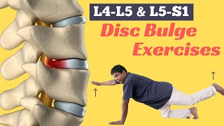 6 Best Diffuse Disc Bulge at L4-L5 and L5-S1 Treatment Exercises