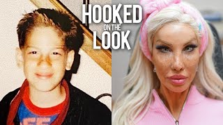 From Teen Boy To $1M Plastic Barbie | HOOKED ON THE LOOK