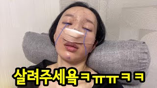 코성형, 지방이식 브이로그❤️ (방금 코 수술, 지방이식 받고 왔어요..🥲) | 분량 조절 실패로 따로 올리는 지방이식, 코 수술 당일 후기😝 TMI 주의🤍