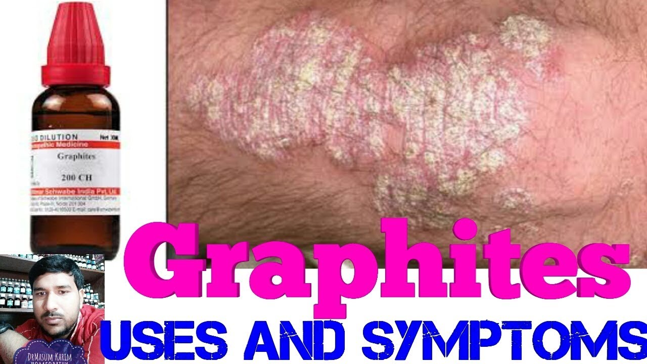 Graphites! Homeopathic Medicine Uses And Symptoms - YouTube