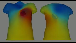 This is why your cardiologist knows what your heart is doing from your ECG.