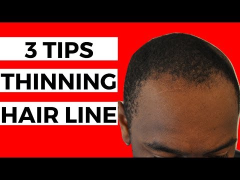 3 Tips For THINNING Hair Line | Black Men Balding 3 Tips For THINNING Hair Line | Black Men Balding