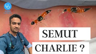 SEMUT CHARLIE : Apa yang anda perlu tahu (2021)