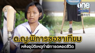 ด.ญ.พิการขอขาเทียม หลังอุบัติเหตุทำพิการตลอดชีวิต | วันช่วยได้ | ข่าวช่องวัน | one31