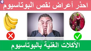 اعراض نقص البوتاسيوم  - الاطعمة الغنية بالبوتاسيوم