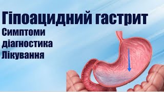 Гіпоацидний гастрит симптоми, причини, дієта, лікування препаратами і методами народної медицини