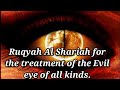 Ruqyah Al Shariah for the treatment of the Evil eye of all kinds.