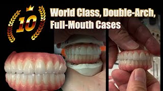 10 World-Class, Double-Arch, Full-Mouth Cases