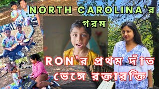 North Carolina তে কেমন গরম পড়েছে!| জীবনের প্রথম দাঁত পরা নিয়ে রক্তারক্তি কান্ড|গরমের ছুটি|Ofc Picnic