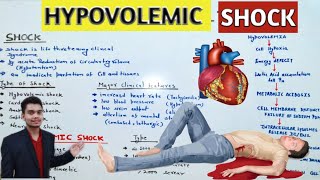 Shock Pathophysiology Of Shock  Hypovolemic Shock In Hindi Shock  Causes Shock Type