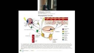 Pathophysiology of Blepharospasm and Photophobia