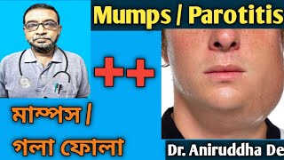 Mumps / Parotitis | মাম্পস / গলা ফোলা  | Homeopathy Dr. Advice in Bengali | @DrAniruddhaDe ||