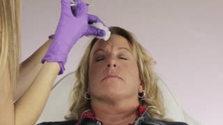 Botox Touch-Up Walkthrough with Liz