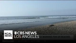 Bacteria warning issued for 6 LA County beaches
