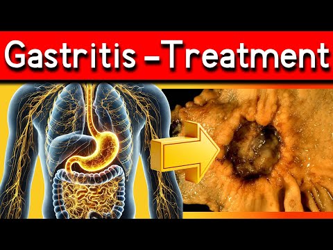 What Causes Nausea And Vomiting In Gastritis