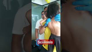 scoliosis treatment by Indian chiropractor Dr.Rajneesh kant