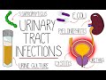 UTI Made Easy - Urinary Tract Infections Explained Clearly