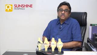 Myths and Facts about Arthritis of Knee and Knee Relplacement