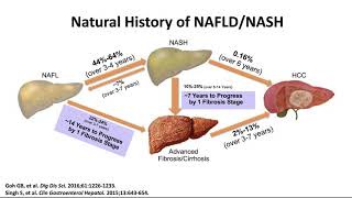 NAFLD series Episode 2 of 4: Looking into the Crystal Ball - Predicting the Future Challenges of Fib