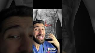 “Lose Weight While Eating What You Want” #how