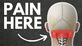 Is Your Headache Actually Coming From Your Neck?!