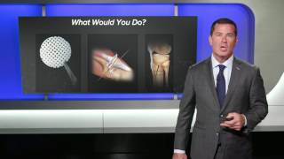 MPFL with AMZ and Cartiform® Viable Osteochondral Allograft | Brian J. Cole, MD, MBA