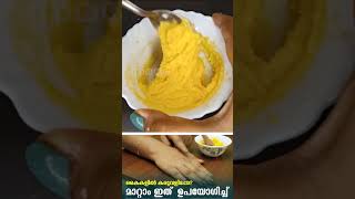 കൈകളിലെ കരുവാളിപ്പിന് പരിഹാരം | Simple Remedy To Treat Tanned Hands