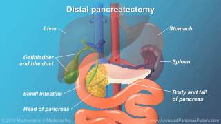 Pancreatic Surgery: Benefits, Risks, and Relevant Anatomy