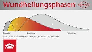 Wundheilungsphasen im Überblick - Exsudationsphase, Granulationsphase, Epithelisierungsphase