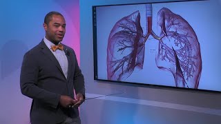 Stages of COPD