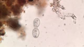 A ciliate undergoing mitosis in time lapse