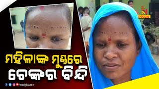 Woman Gets Burn Scars To Get Rid of Headache | NandighoshaTV