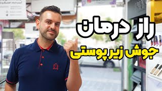 جوش صورت: آیا شما هم از راز درمان جوش زیر پوستی باخبرید؟