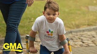 Double amputee, 5, raises over $1 million