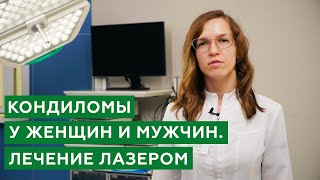 Кондиломы у женщин и мужчин / Лечение анальных кондилом лазером