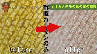 この差！「見えない...」とは言わせない！核の染色のコツ【011生物基礎】