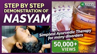 Nasyam | Learn to do Nasyam at Home | Ayurshi Ayurveda Chennai