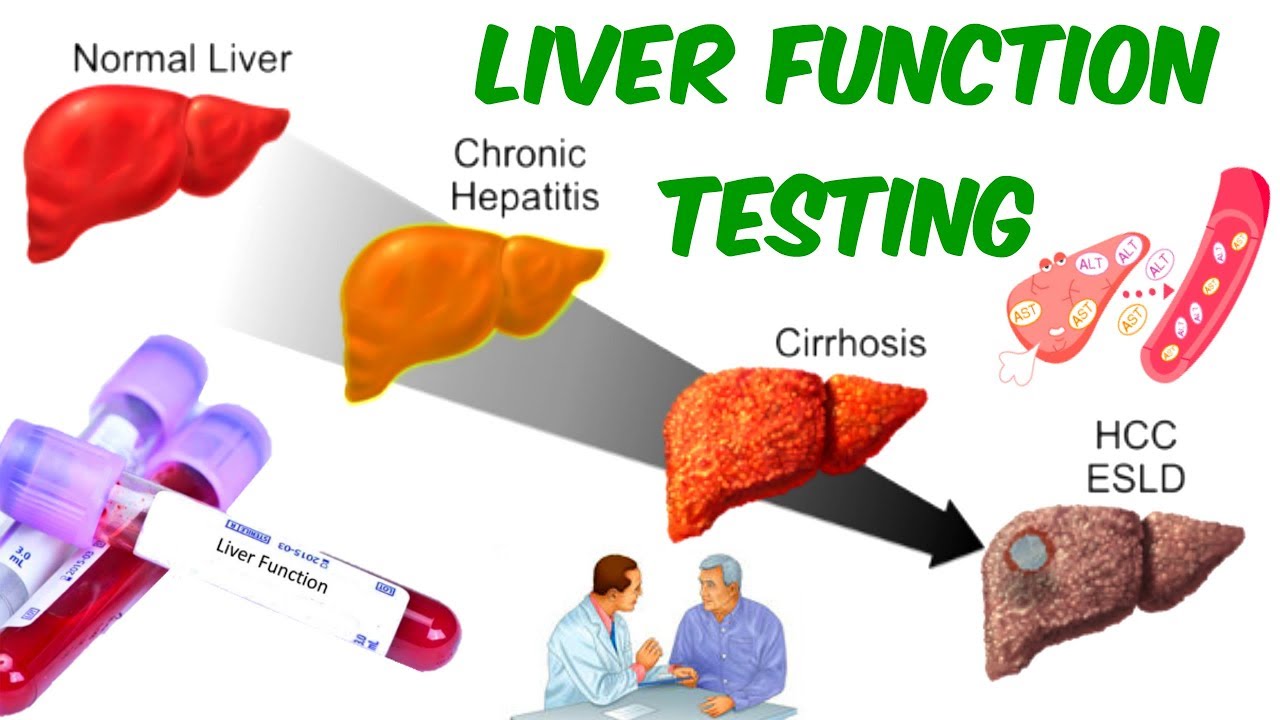 LIVER FUNCTION TESTING! - AST, ALT, And ALP- Is Your Liver In SERIOUS ...