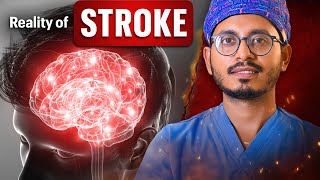 Why Young People Are Getting Brain Strokes ?