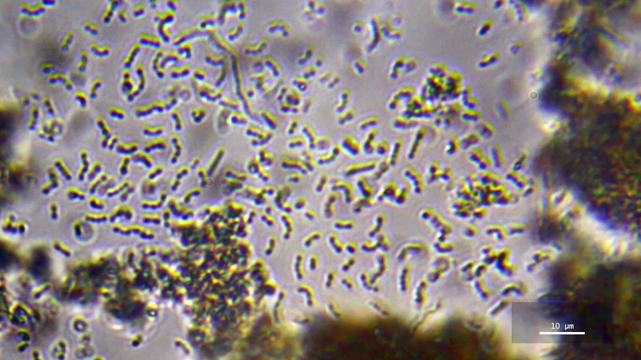 Yogurt Under Microscope At William Fellows Blog