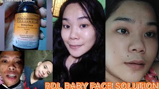 RDL BABY FACE SOLUTION 1 WEEK RESULT!!!