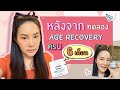 หลังจากที่ลองครีม Age recovery มา6เดือน | starbeautyshop